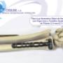 placa lcp 3.5 mm  radio distal anatomica dvr titanio