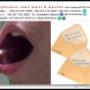 Subido por visitante en 4/3/2018 - Toma de muestra en adulto y colocación de muestras