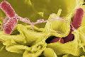 TODO LO QUE DEBEMOS SABER SOBRE LA SALMONELLA