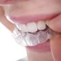 ferula dental