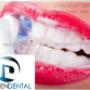 IMAGEN DENTAL LIMPIEZA MARACAIBO
