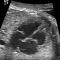 Ecocardiografía-fetal